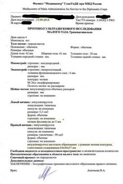 Лечение кисты яичника