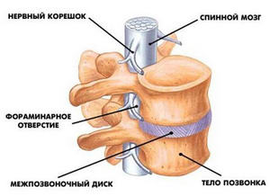 Боли в спине Боли в спине